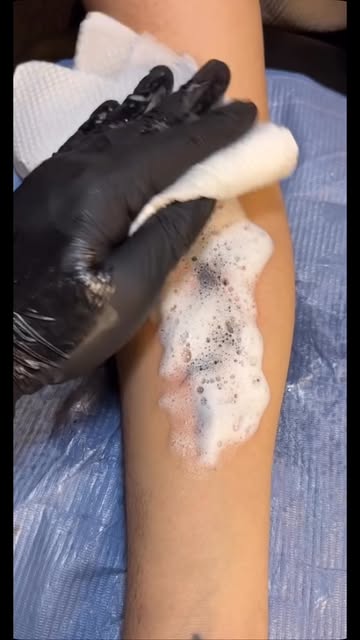 Nachsorge eines frischen Tattoos mit Einweghandschuhen